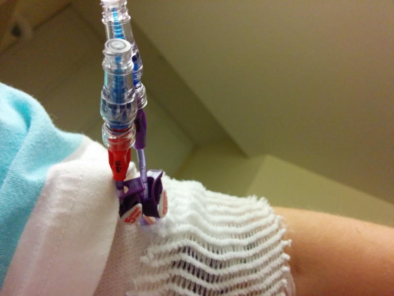 Infusion day